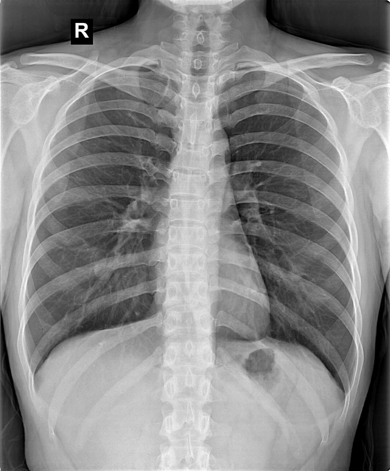 Venv1717X imaging example